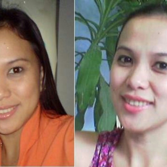 Other - Extraordinary results....kojic lightening soap Other - Extraordinary results....kojic lightening soap